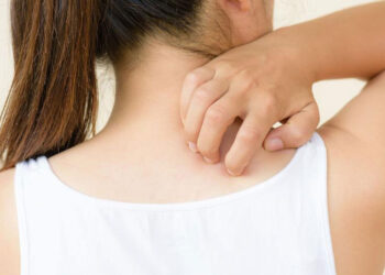 পিঠের ব্রণ থেকে মুক্তির ঘরোয়া এবং সহজ উপায়